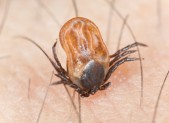 image of a tick on human skin, the cause of Lyme Disease