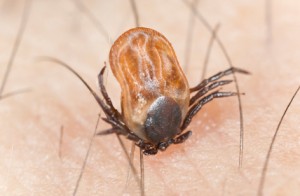 image of a tick on human skin, the cause of Lyme Disease