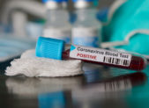 Montgomery Recibirá Semanalmente al menos 7,500 pruebas de COVID-19 featured image - Coronavirus Blood Test Covid-19 istock