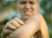 featured - istock mite bite mosquito bites bug itch itchy rash